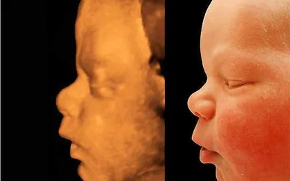 Photo de Cadeau Prénatal Echographie 3D4D Baby Movie / CANNES PACA